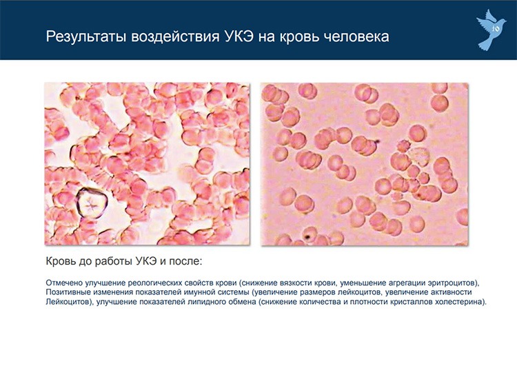 Результаты воздействия УКЭ на кровь человека